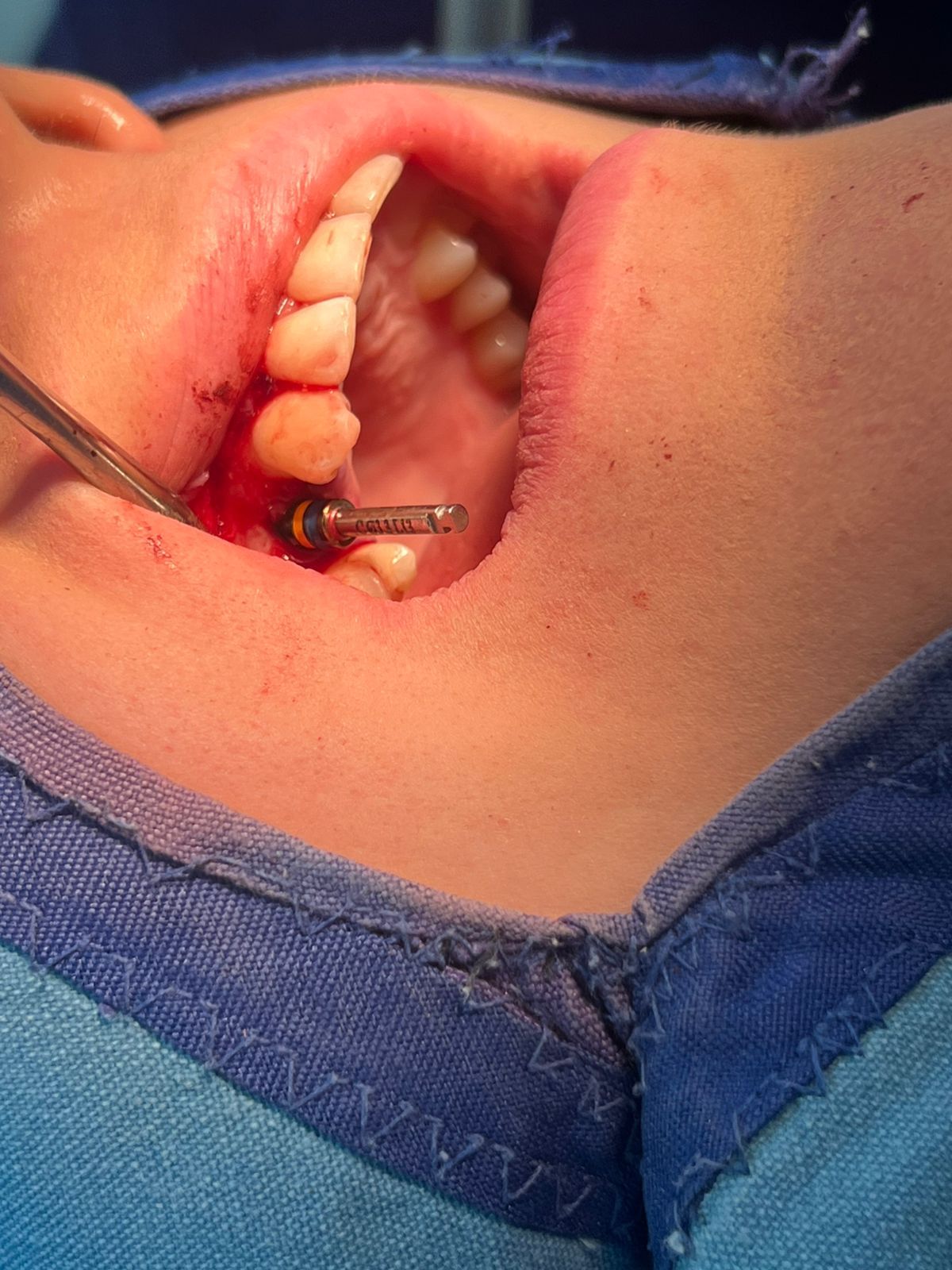 Jair Contreras García-38