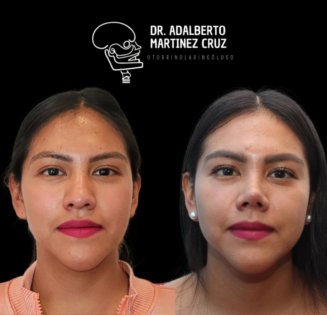 Adalberto Martínez Cruz-23