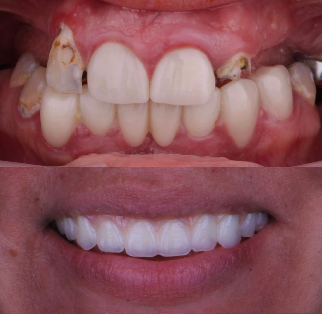 Josué Márquez Gómez-40