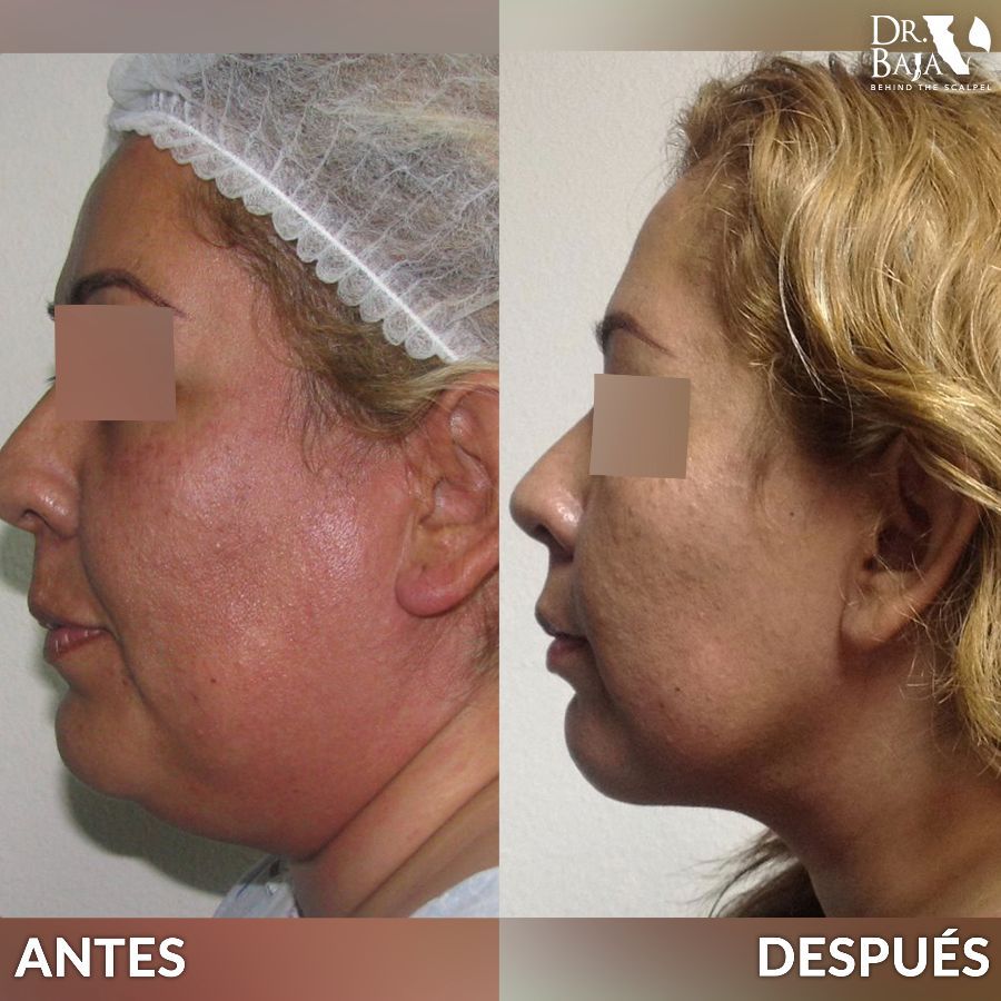 Renato Rodríguez Hirales-49