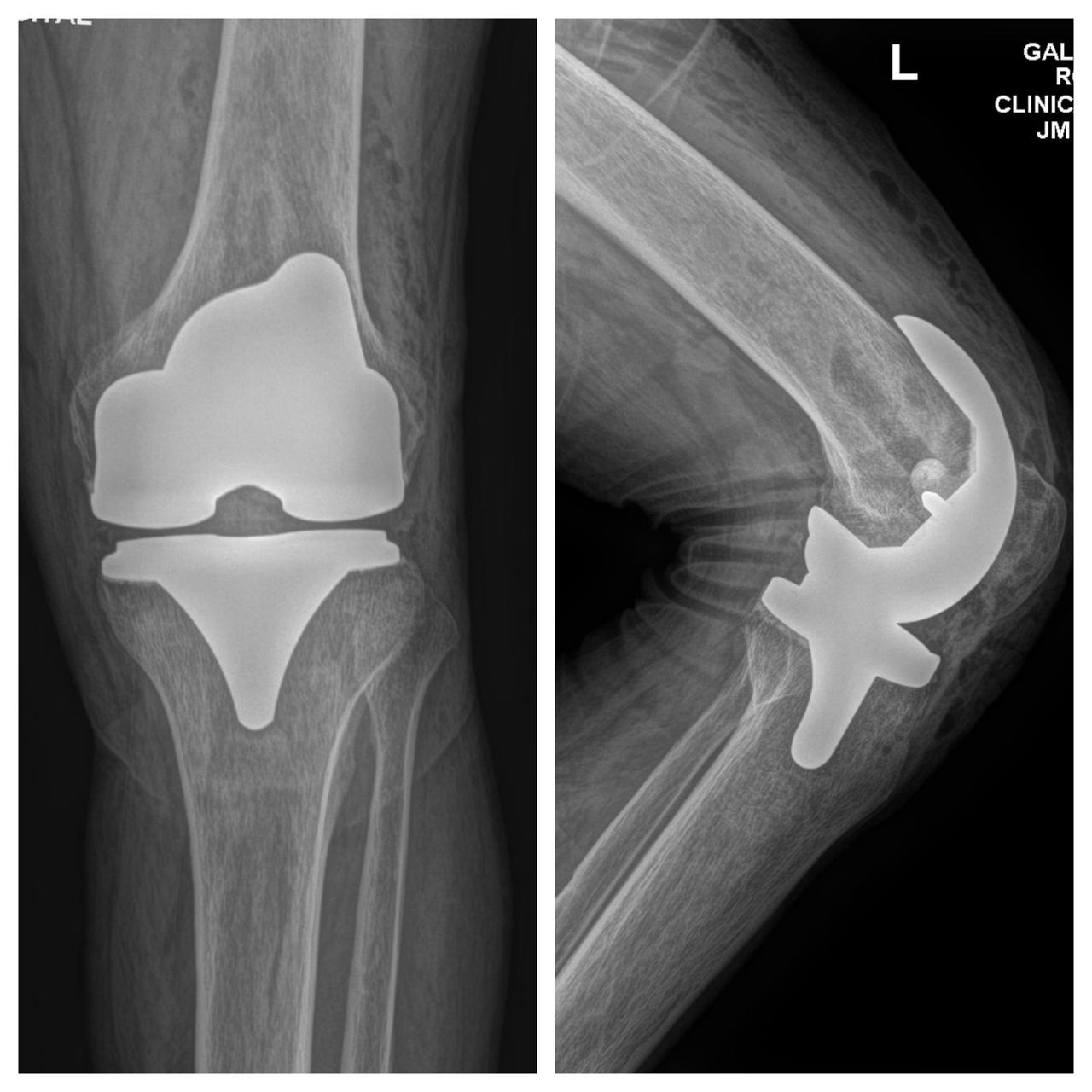 Abraham Gutiérrez Ávila-16