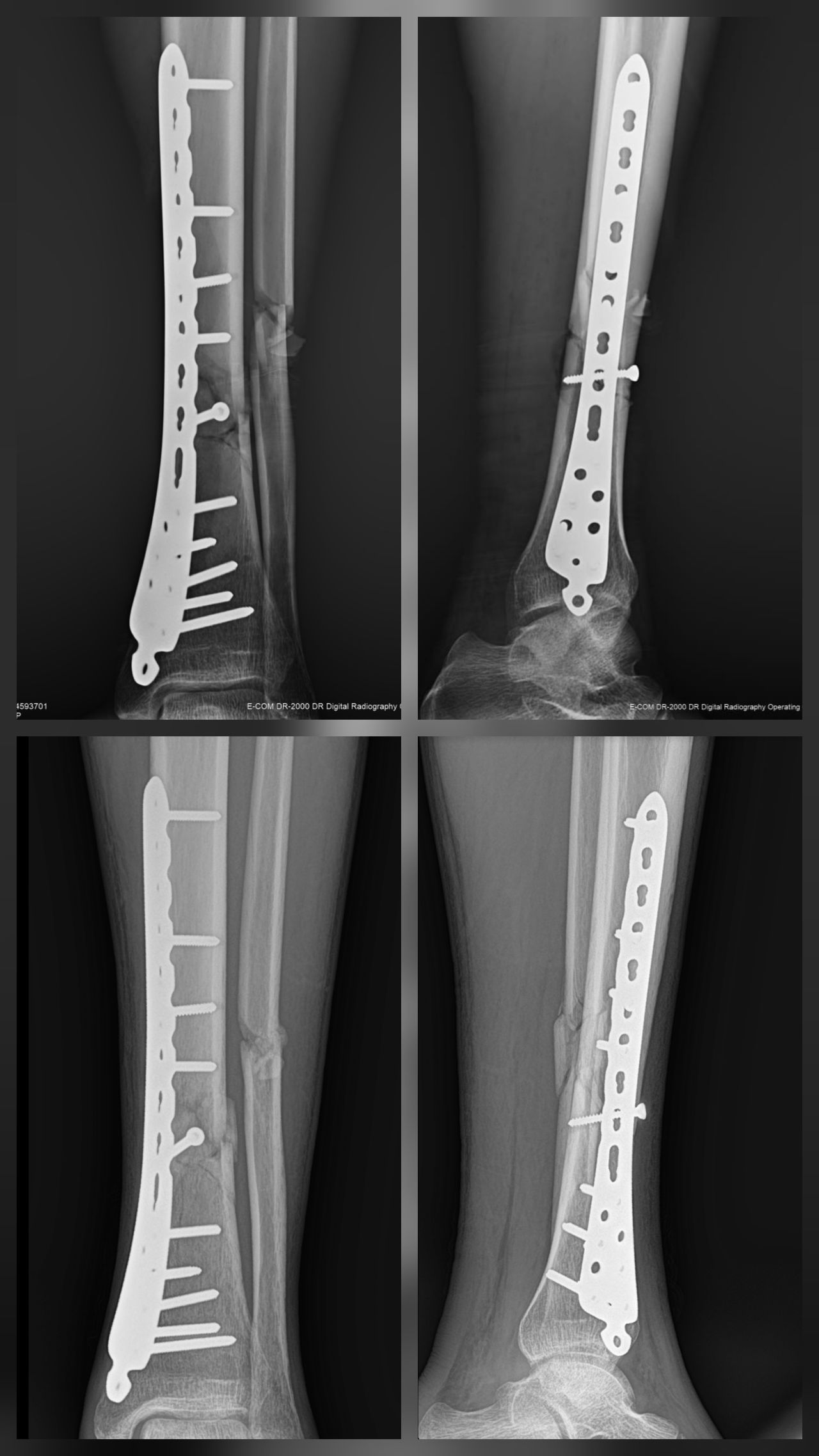 Amando Ramirez Zavala-3