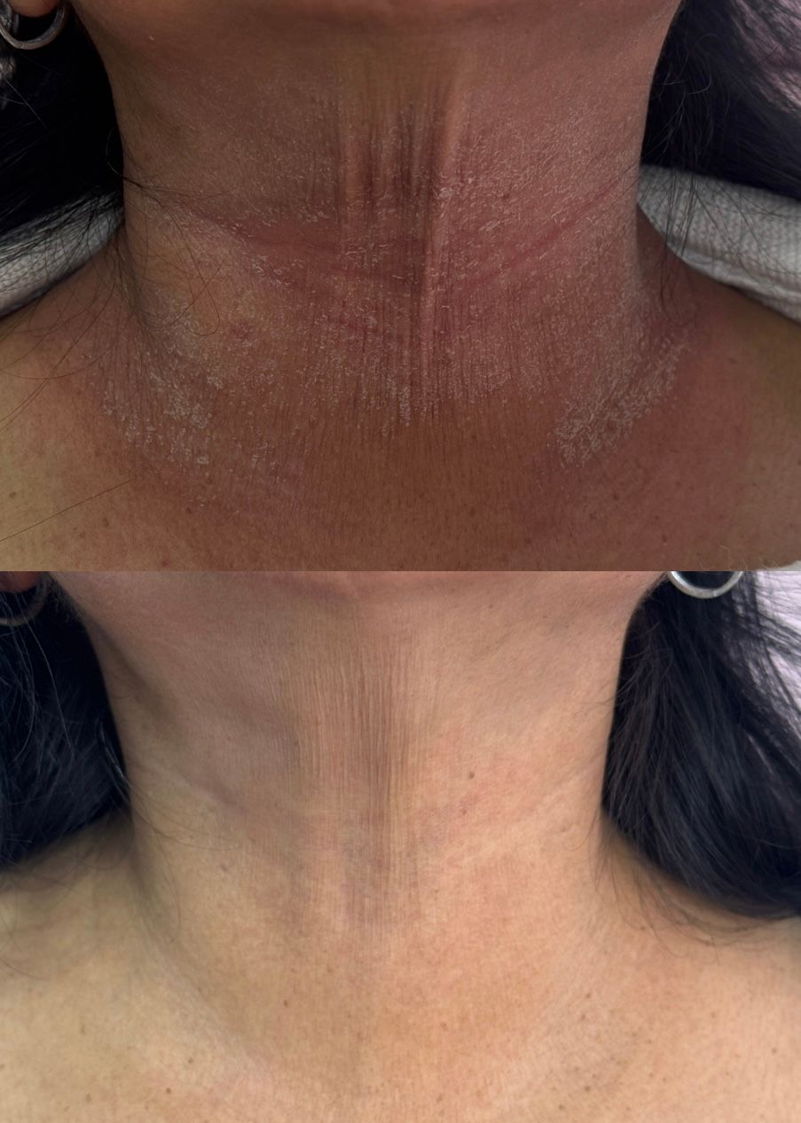 Melissa Burgos Romero-19