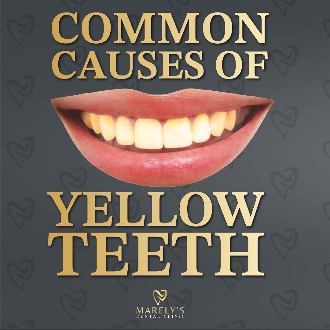 Luz Marely García Alvarez-7