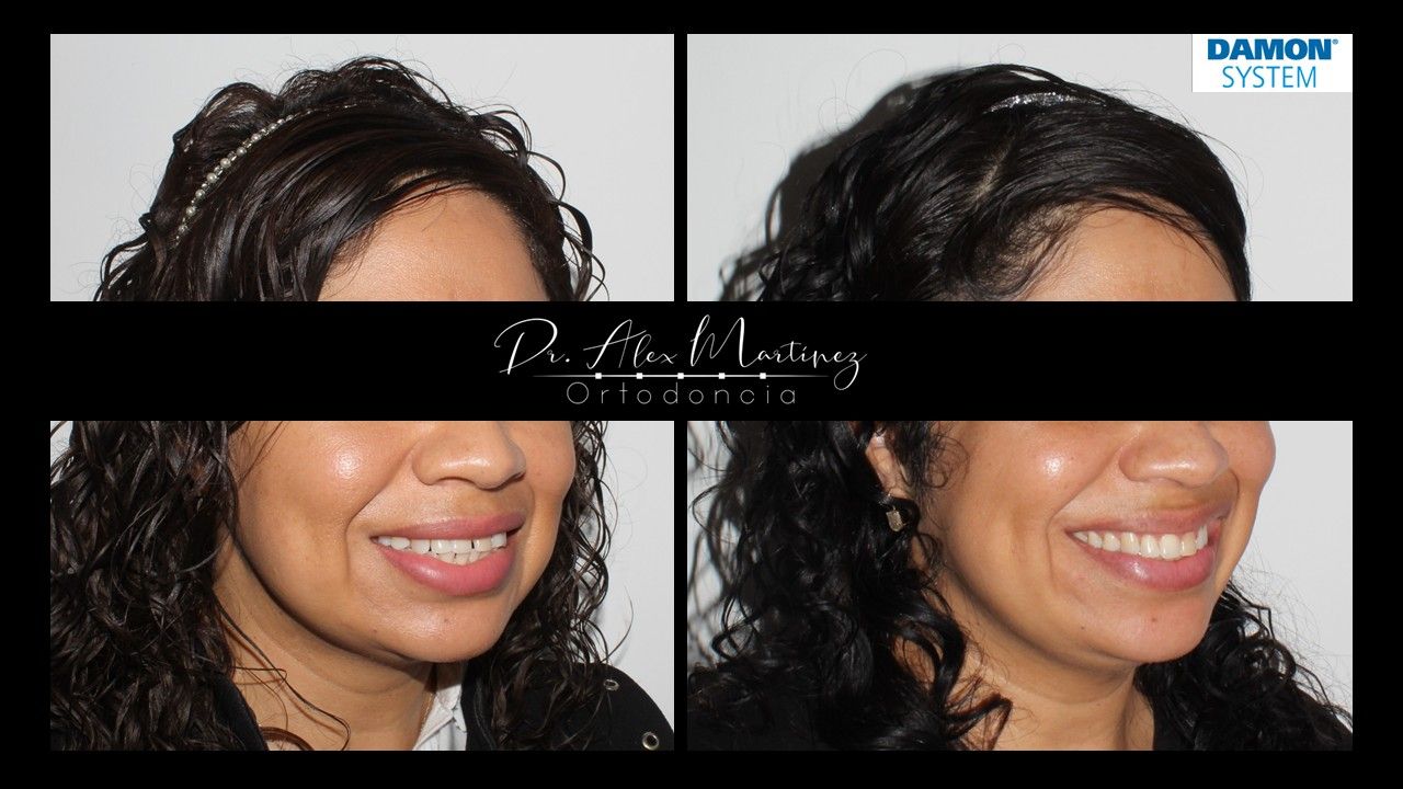 Alejandro Martínez Hernández-19