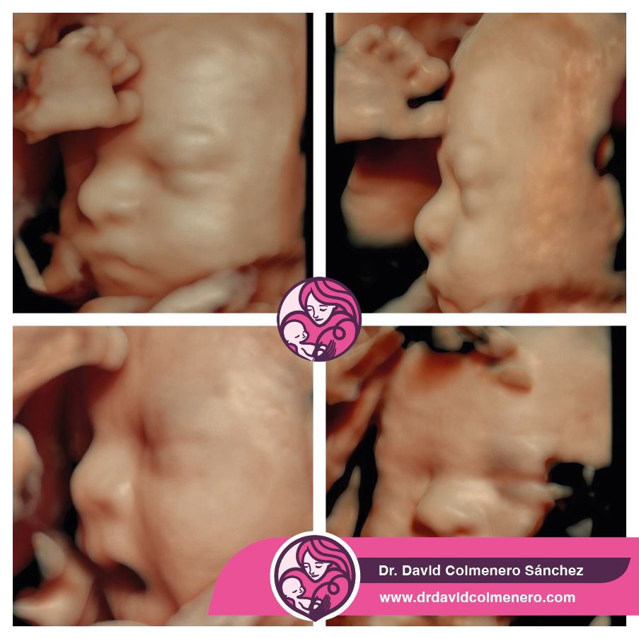 David Colmenero Sánchez-17