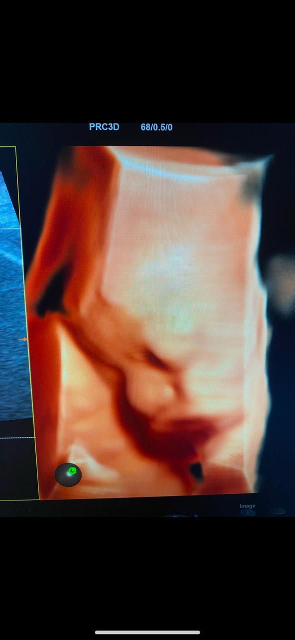 Graciela Elizabeth De La Torre Alvarez-11