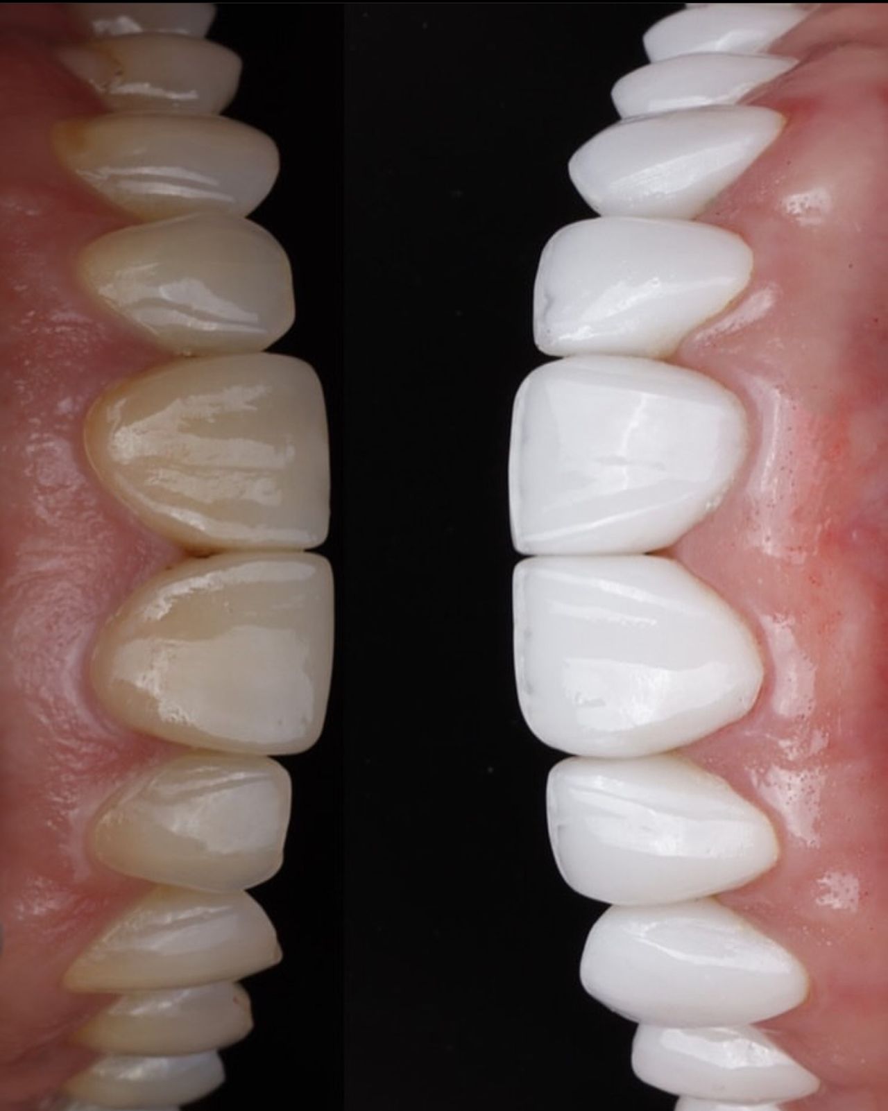 Angel Gabriel Hernández Sánchez-1