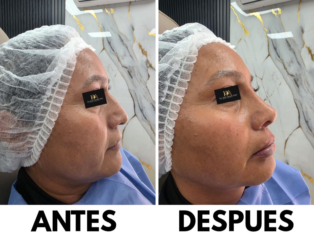 Karla Alamilla Yañez-4