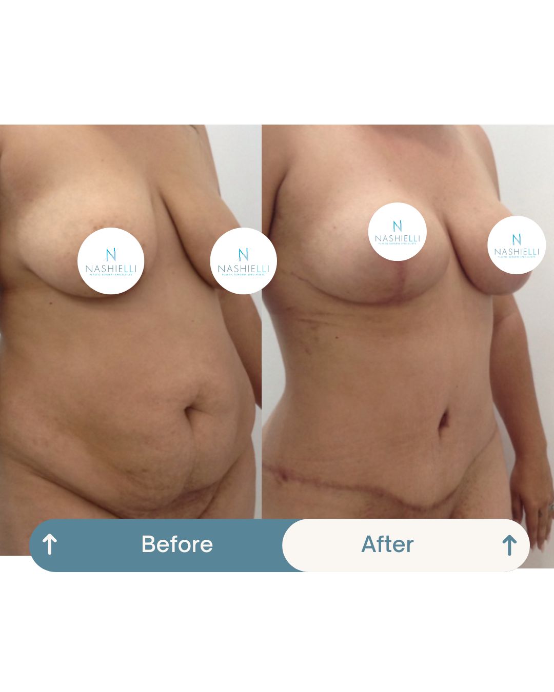 Nashielli Torres Espinosa Chiu-38