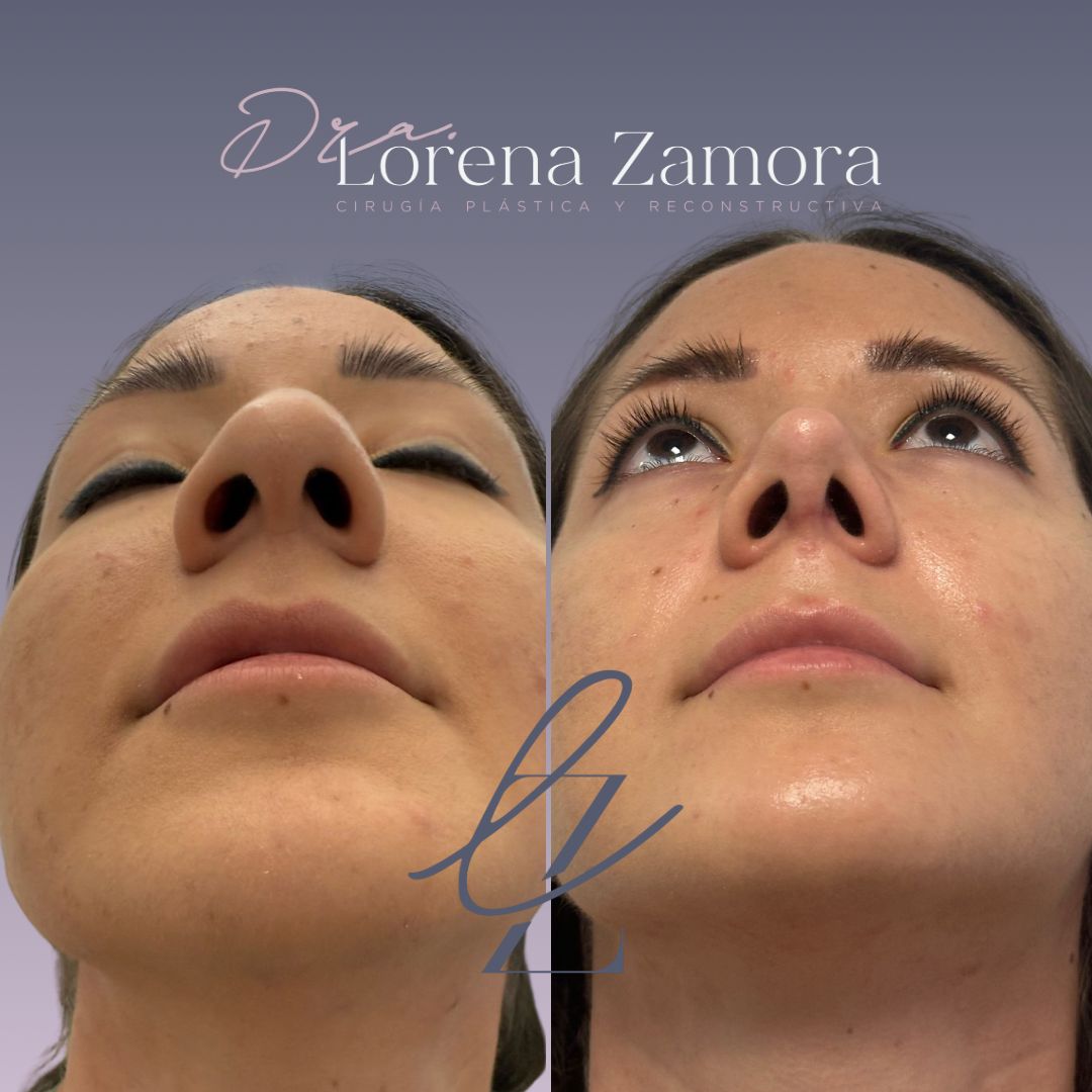 Lorena Zamora Pérez-3