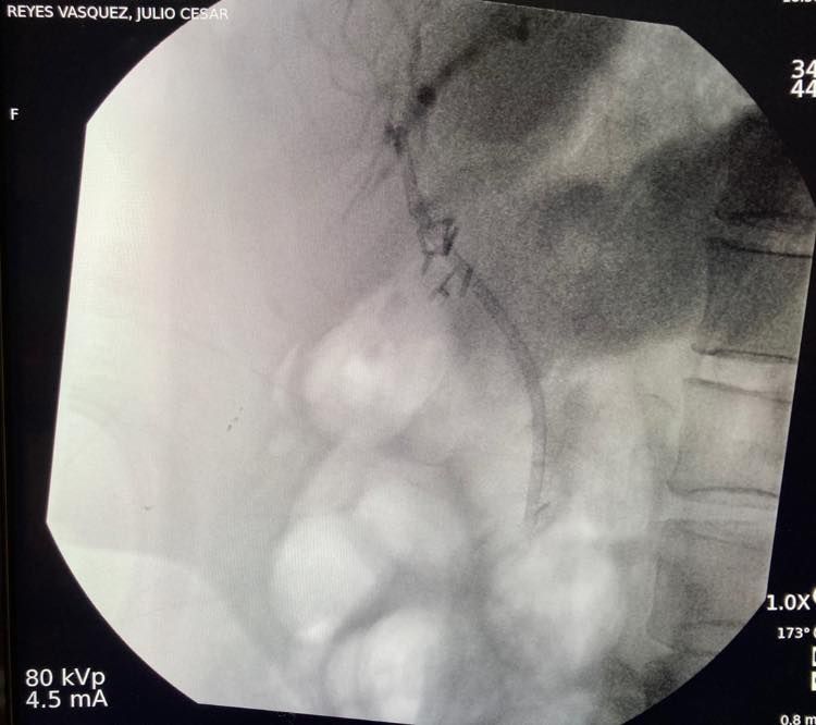 J. César Reyes Vásquez-14