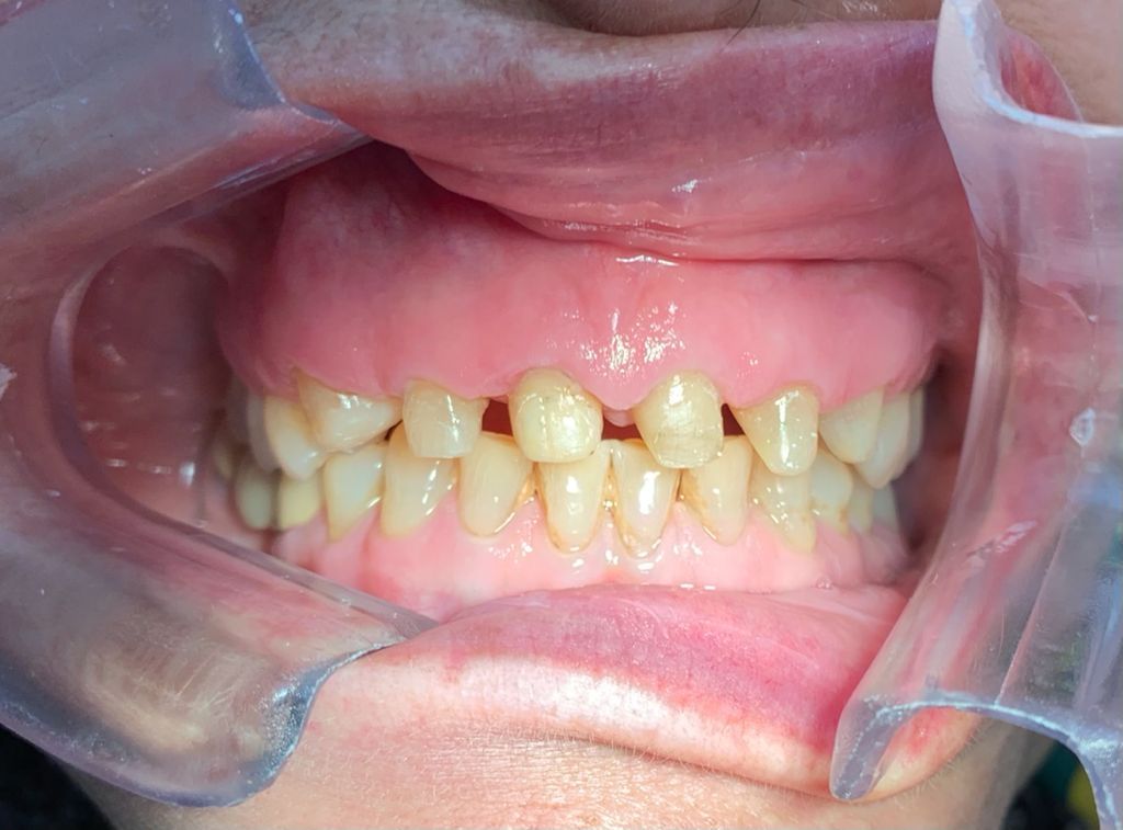 Yuriria Gochy Escalante-12