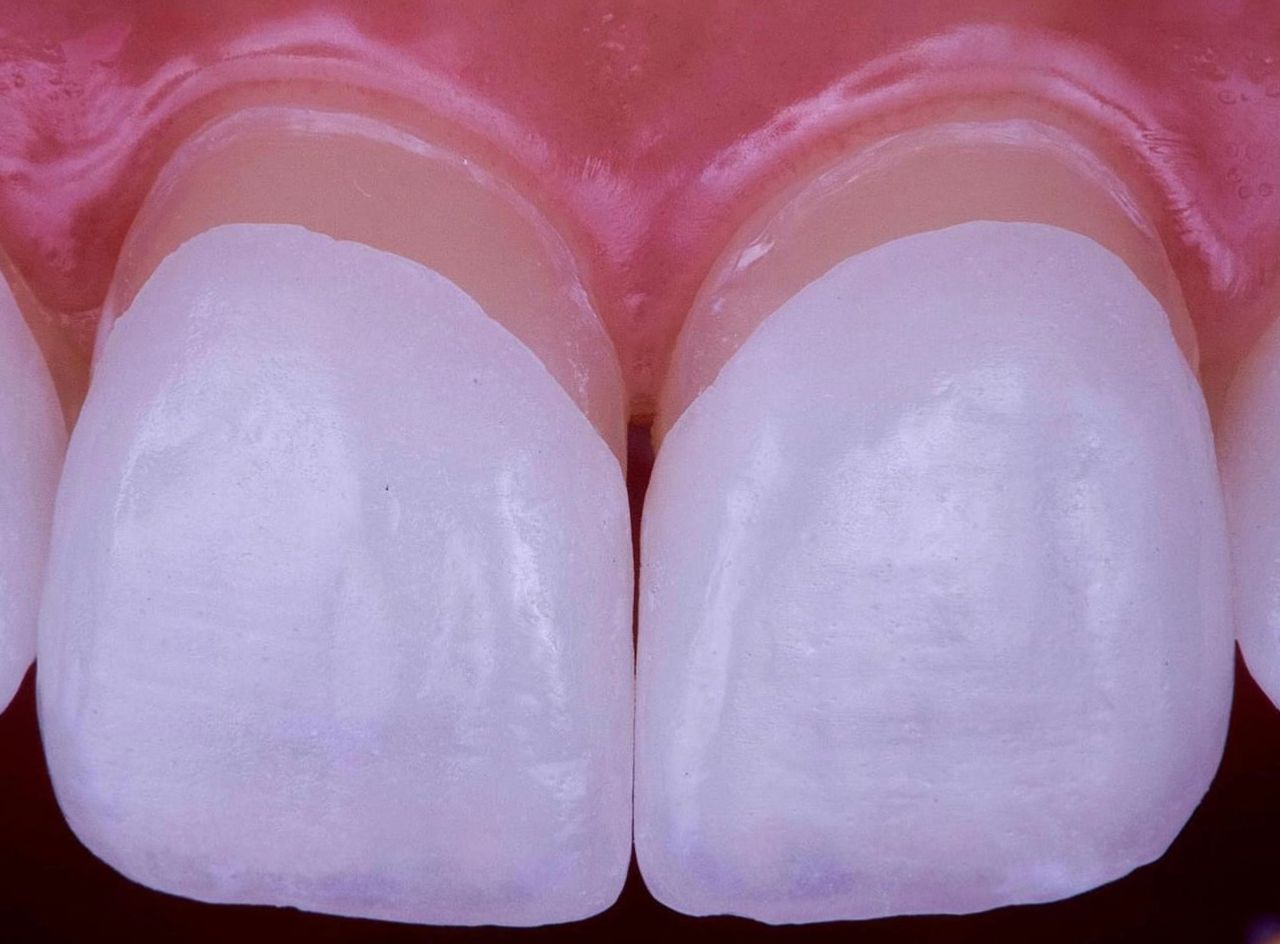 Ernesto Rojas Calderon-50