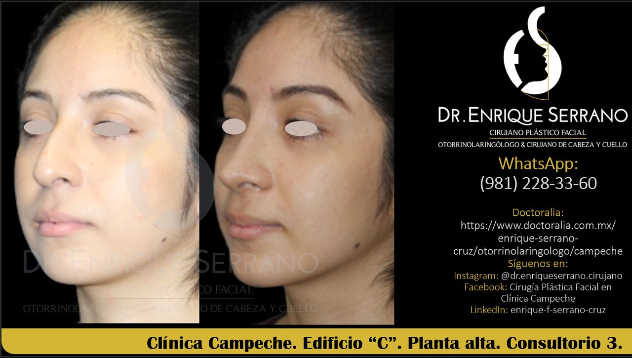 Enrique Serrano Cruz-78