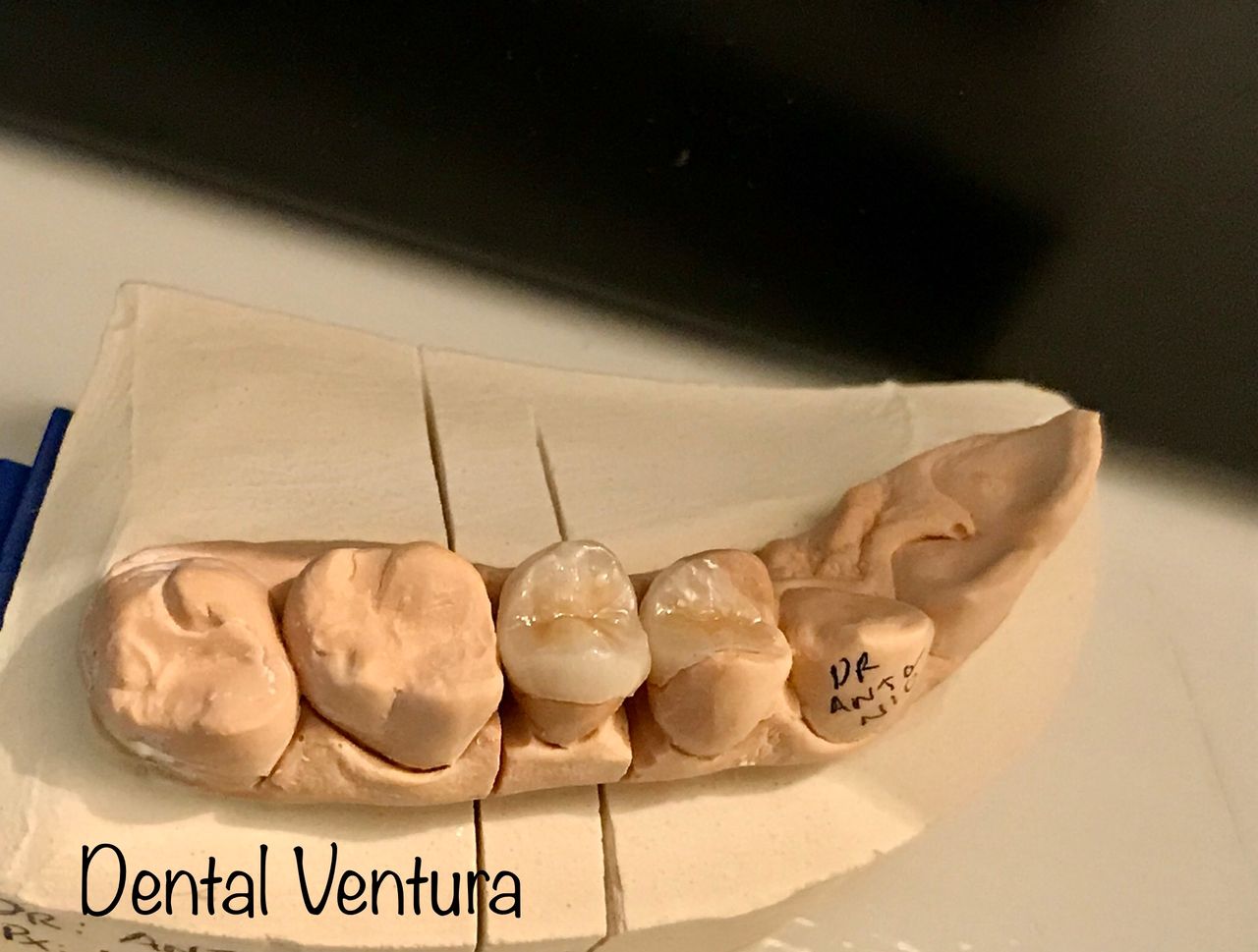 Antonio Cerda Ventura-21