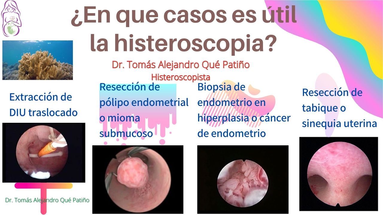 Tomás Alejandro Qué Patiño-14