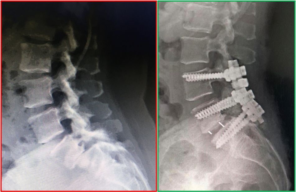 José Guillermo Chapa Cárdenas-0