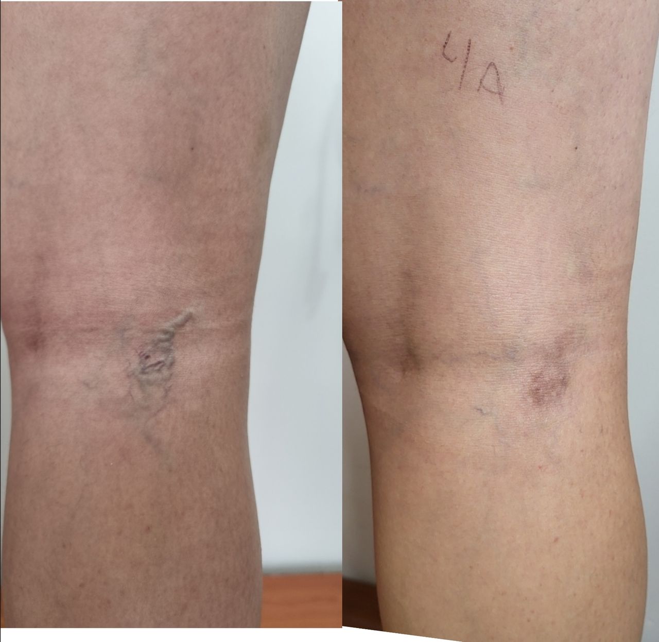 Héctor Emmanuel Alarcon De La Peña-5