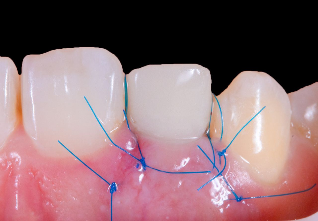 Hugo Enrique Aguilar Lamas-81