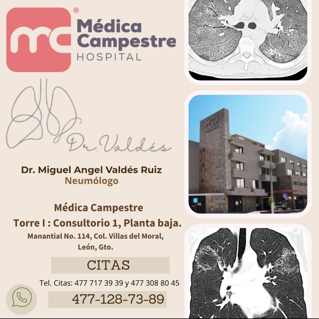 Miguel Angel Valdes Ruiz-1