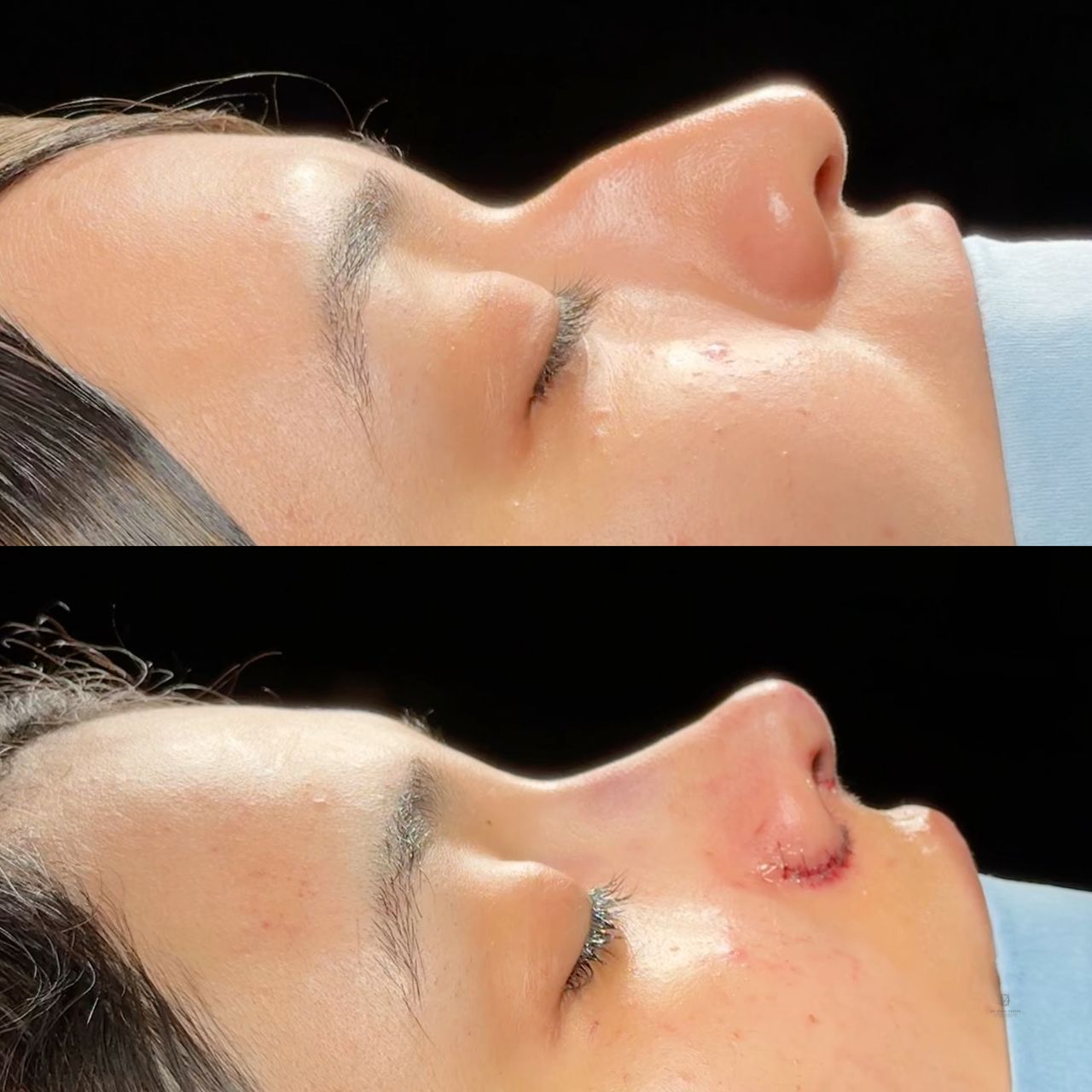 Angel Castro Urquizo-227