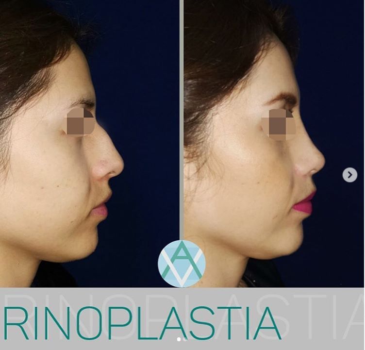 Alfonso Villaseñor Herrero-20