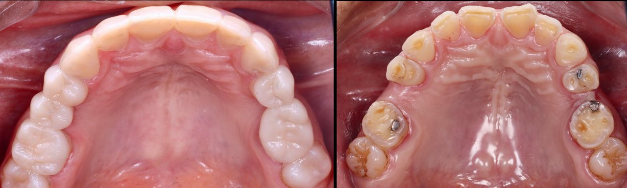 Alexandro Castrellon-4