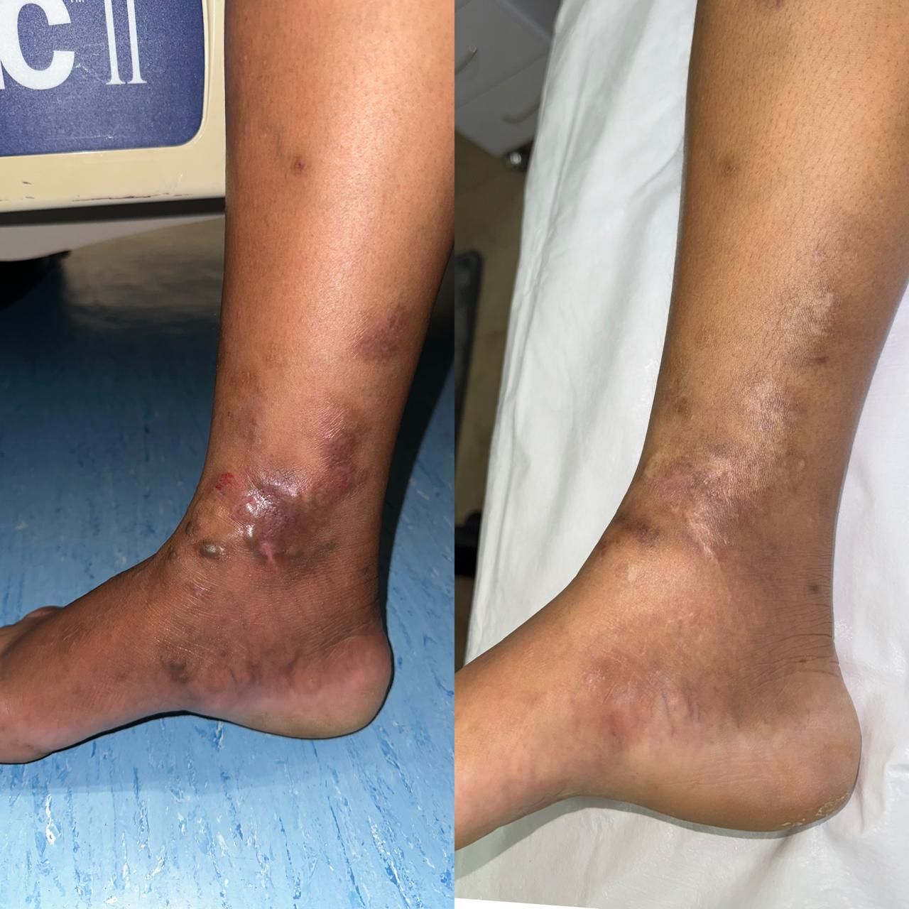 Jhonatan López González-12