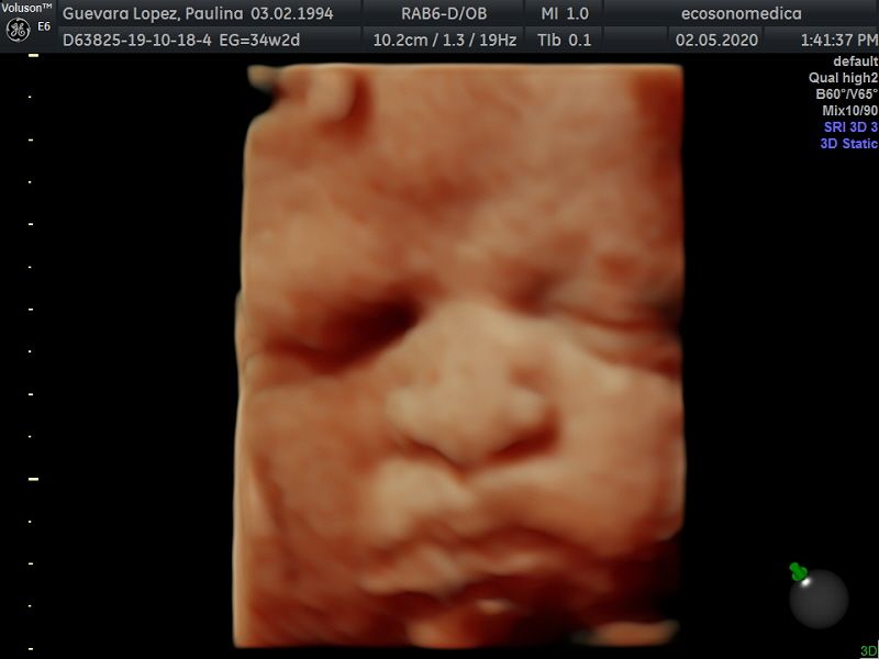 Héctor Bernardo Acevedo Manrique-25