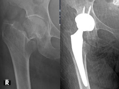 Luis Castañón Robles-23