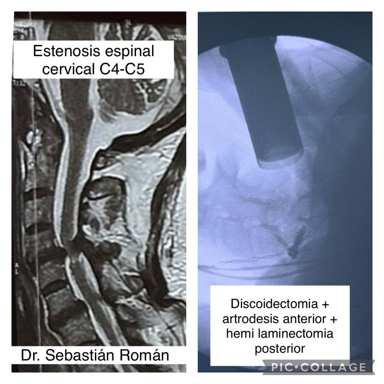 Sebastián Rodrigo Román González-9