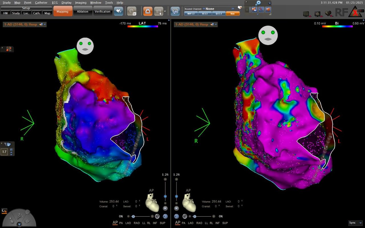 Elias Andrade Cuellar-4