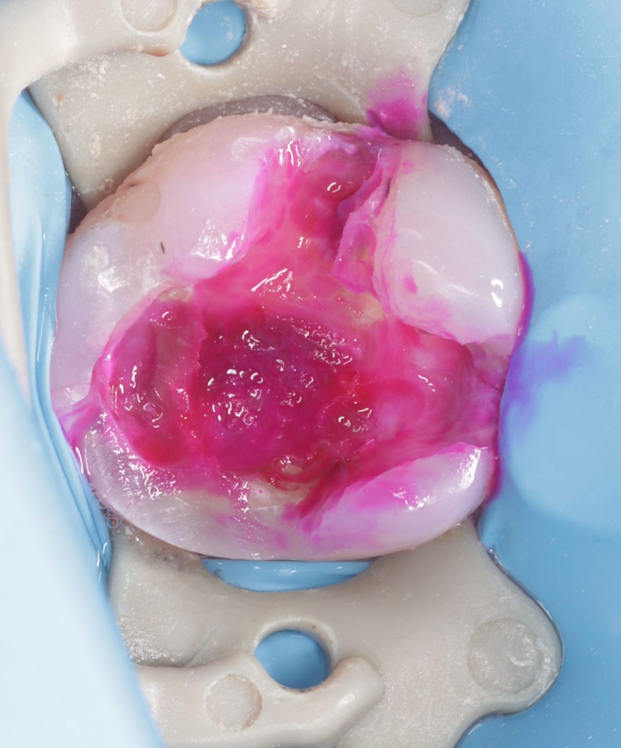 Fredy Alejandro Roblero Gónzalez-53