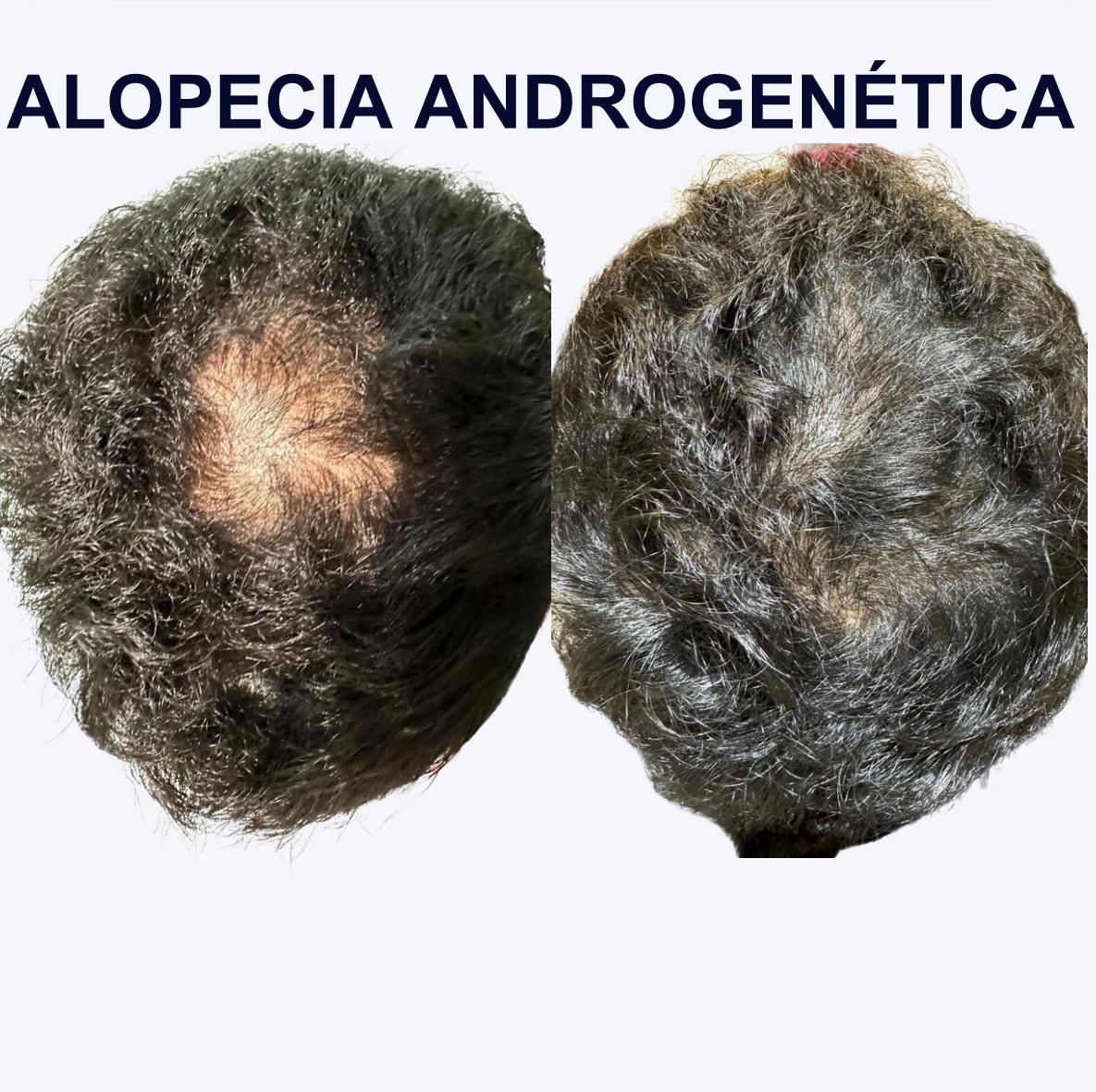 Itzel Anayn Flores Reyes-5