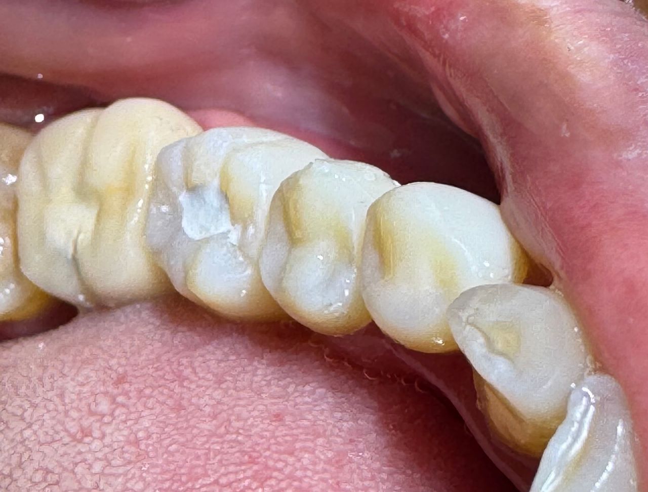 Luis Angel Carranza Resendez-10