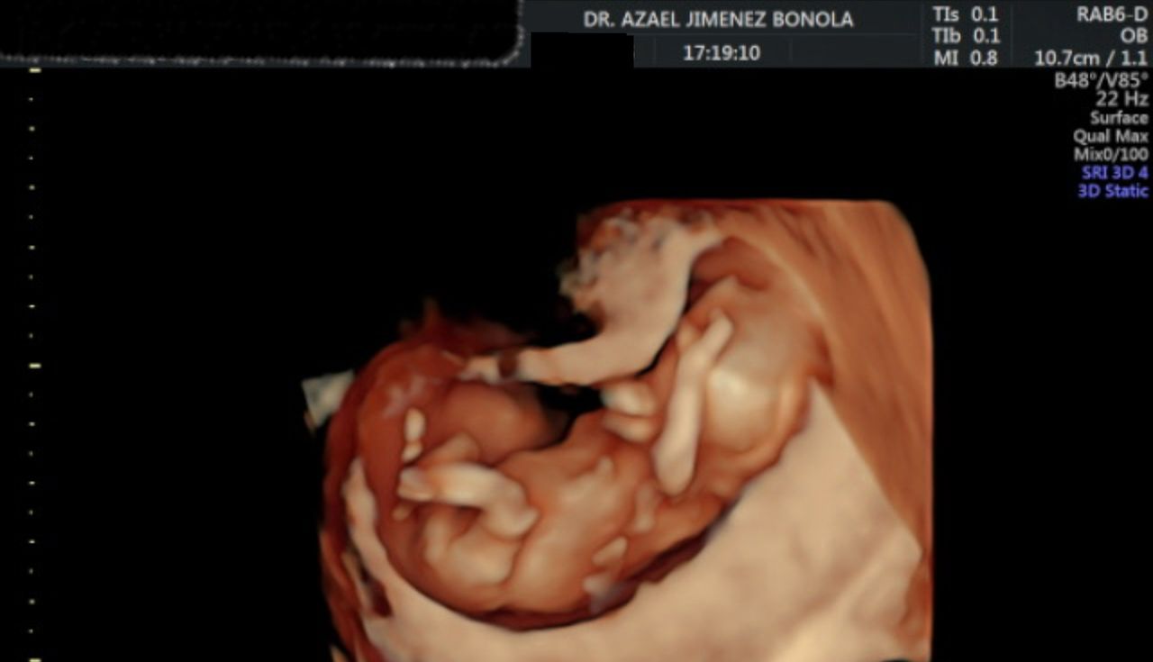 Azael Jiménez Bonola-5