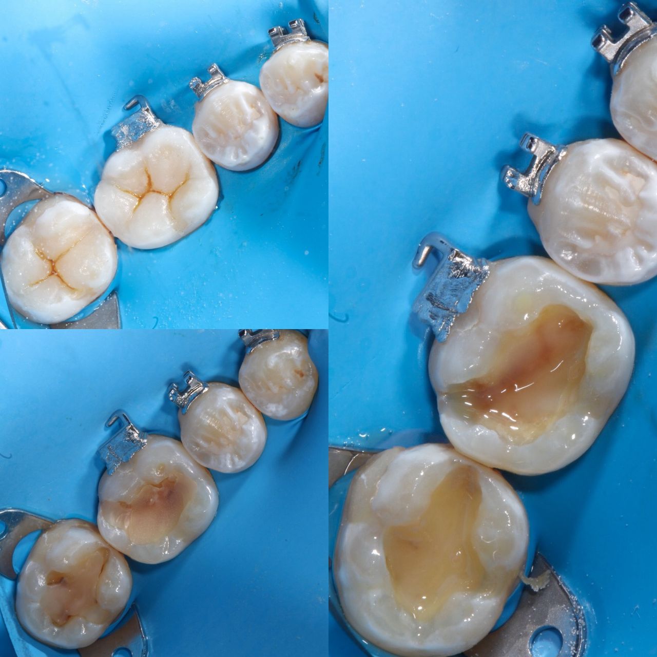 Hervin Eduardo Mendez Borrego-14