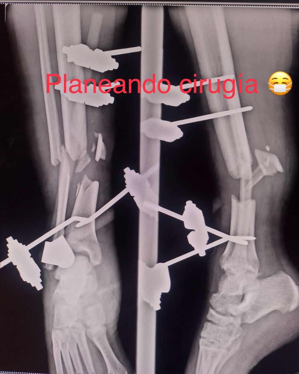 Emmanuel Bolaños Cortes-15