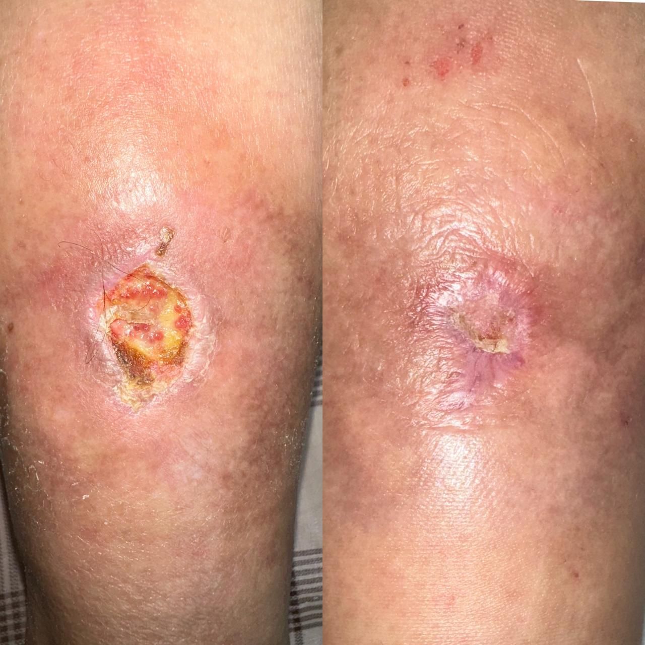 Jhonatan López González-29