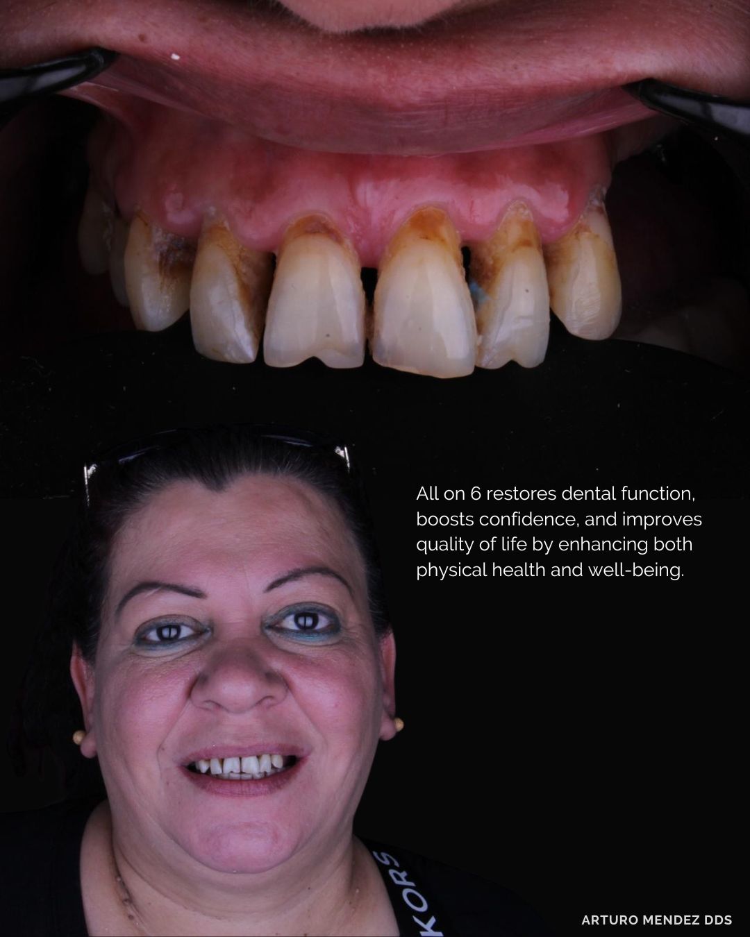 Arturo Mendez Valencia-31