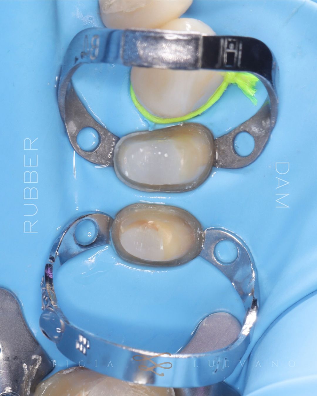 Leticia Isabel Luevano Lozada-2