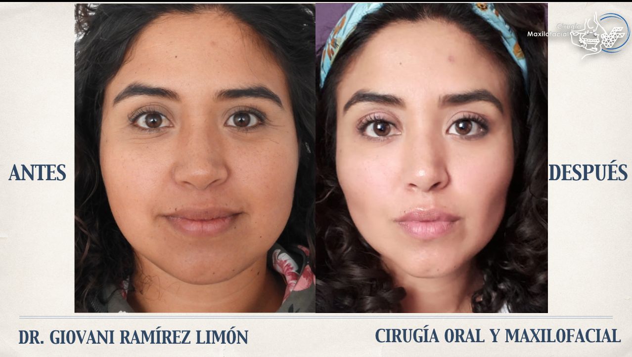 Giovani Ramírez Limón-41