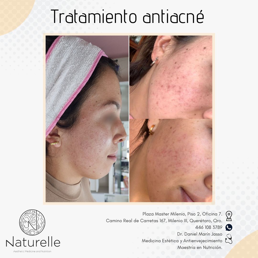 Daniel Marín Jasso-10