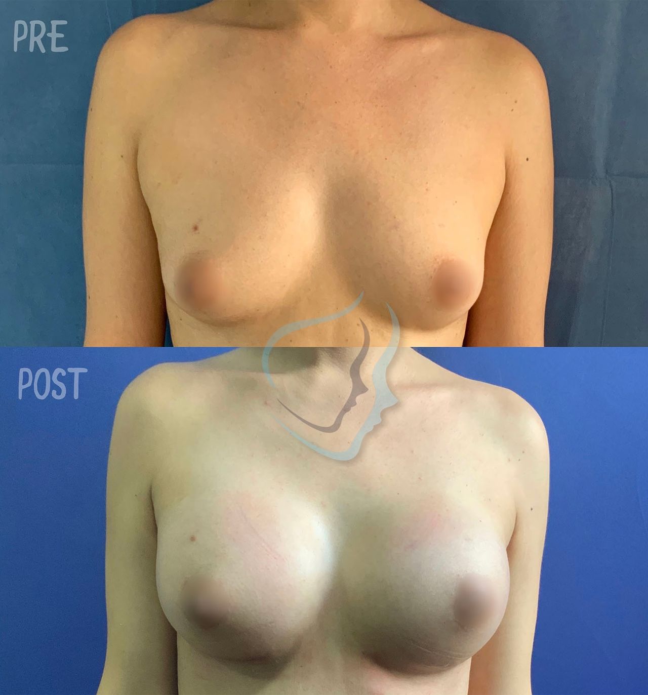 Giuseppe Tanzillo-51