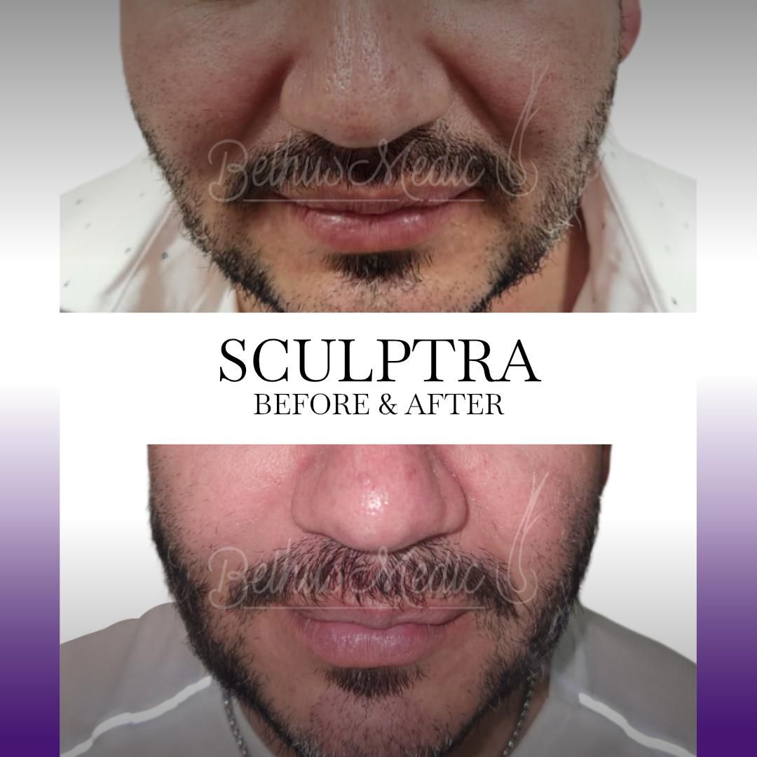 Alejandra Soriano Elorza-95