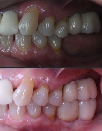 Ireri Rojas Bermúdez-16