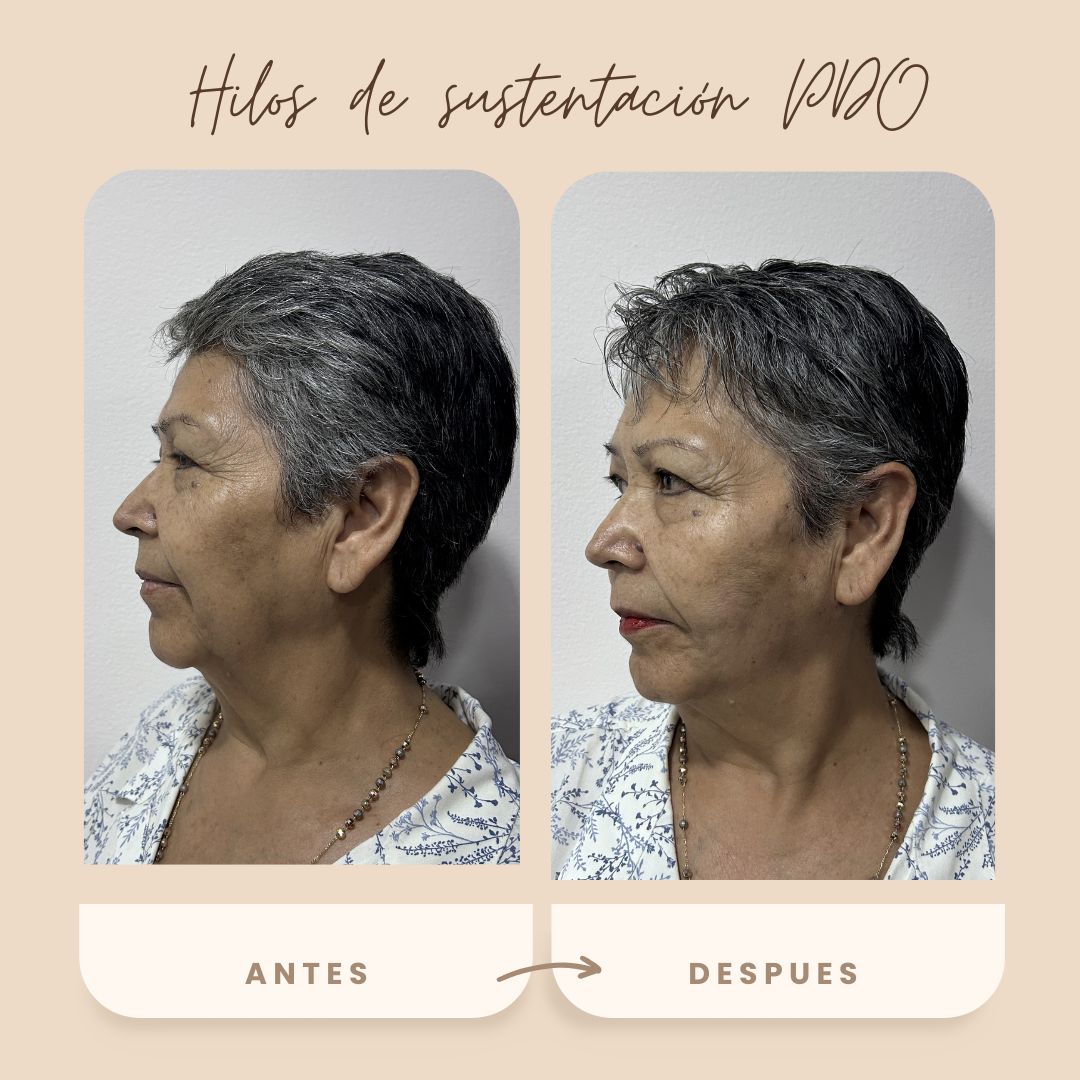 Sinue Hazael  Aguilar Hernández -7