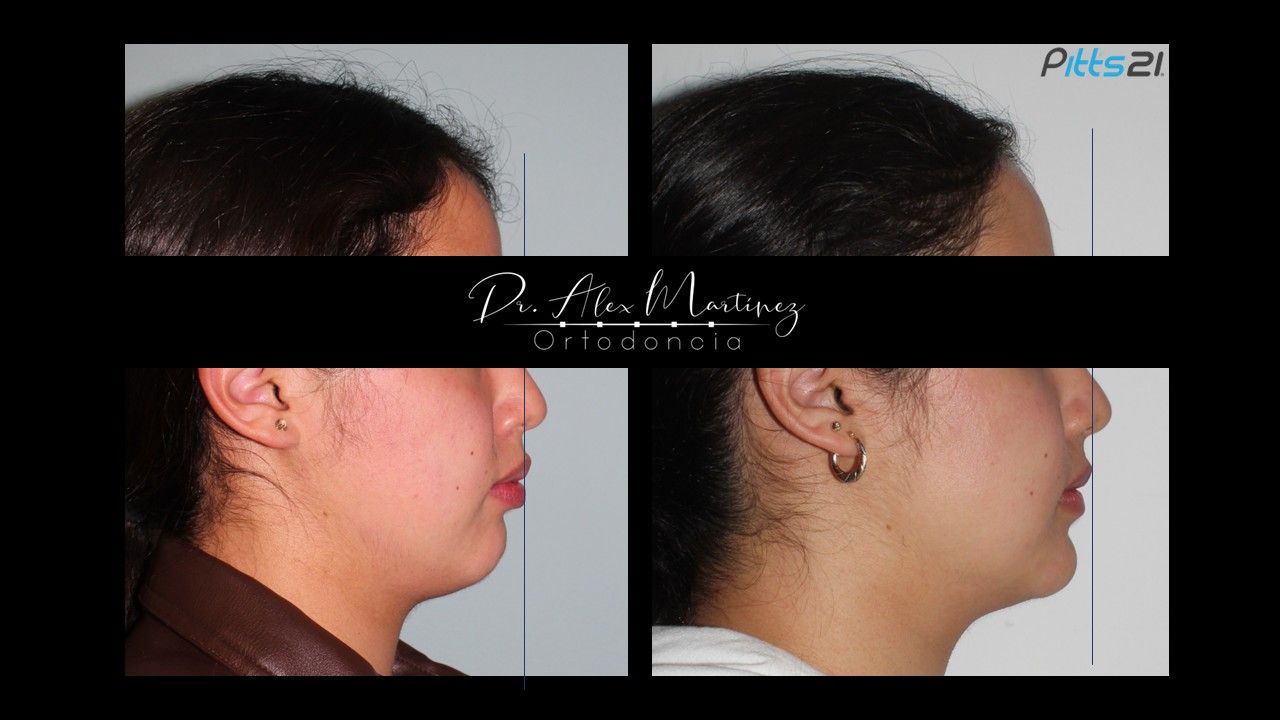 Alejandro Martínez Hernández-12