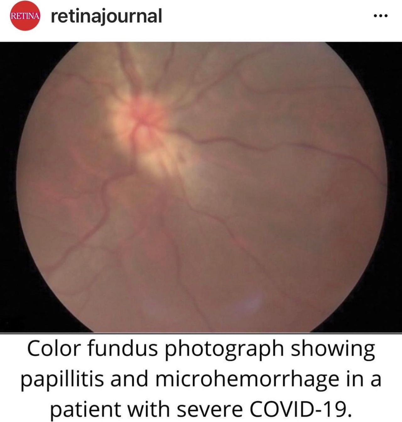 Rosa María Romero Castro-29